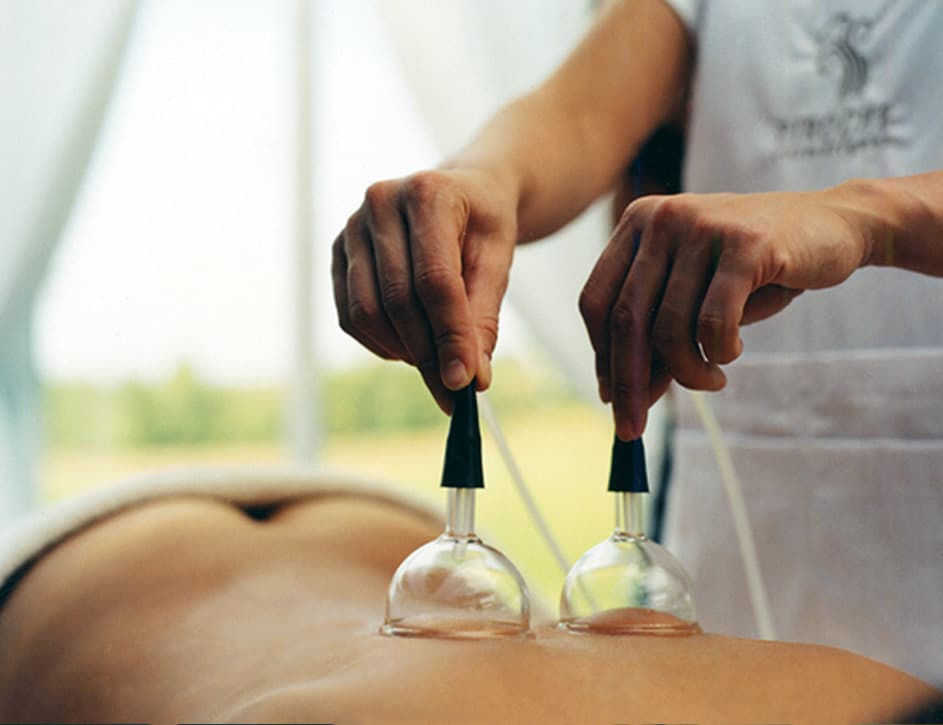 Terapia con ventosas de medicina china en Hathor, Bilbao